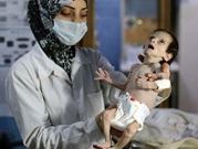 سورية: 1100 طفل يعانون سوء تغذية حاد في الغوطة الشرقية المحاصرة