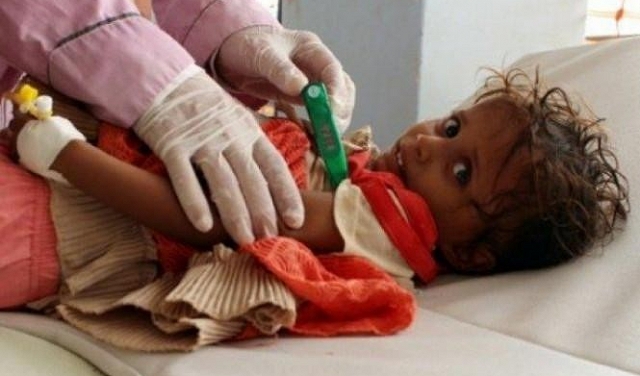 اليمن السعيد: ارتفاع ضحايا الكوليرا إلى 2180