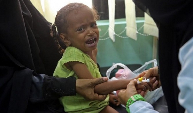  الكوليرا قد تعاود الانتشار في اليمن بسبب نقص المساعدات