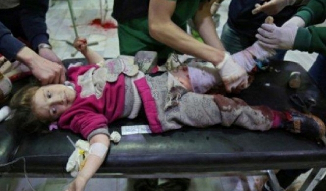 مقتل 37 مدنيا حرقا بقصف روسي بالنابالم على الغوطة