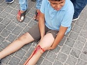 إصابة طفلين دهسهما مستوطن شرق قلقيلية