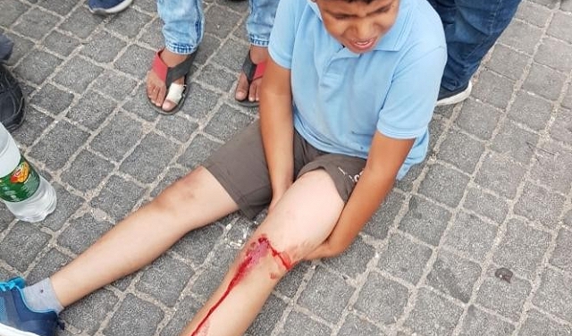 إصابة طفلين دهسهما مستوطن شرق قلقيلية