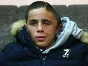 الاحتلال يعتقل الطفل الجريح محمد التميمي من النبي صالح