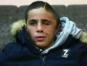 الاحتلال يفرج عن الطفل محمد التميمي بعد اعتقاله لساعات