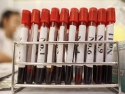 دراسة: اختبار دم يكشف عن النوبات القلبية بشكل فوري