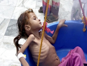 8 ملاييين يمني لا يعرفون متى سيتناولون وجبتهم الغذائية التالية