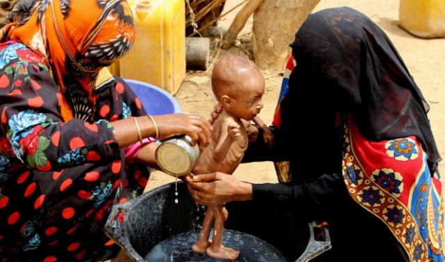 المجاعة تهدد اليمن والتحذير من تفشي الكوليرا بالحديدة