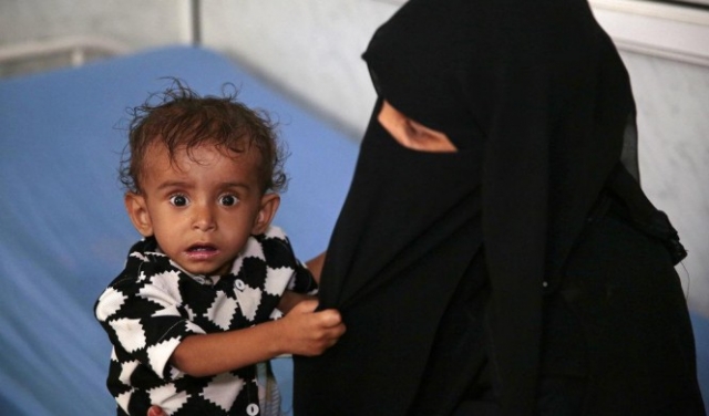  اليمن على مشارف أكبر مجاعة في العالم