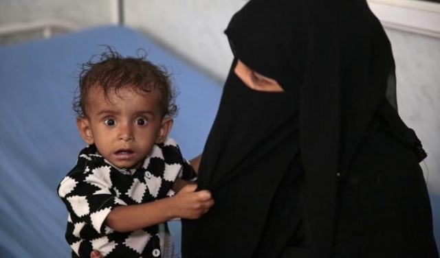  18 مليون يمنيّ مُعرّضون للمجاعة