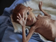 منظمة إنسانية: 85 ألف طفل يمني توفوا بسبب الجوع