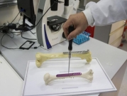 تركيا: براءة اختراع في تطويل العظام