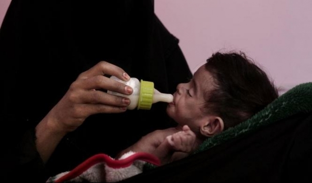 اليمن: 10 ملايين شخص يُعانون من الجوع الشديد