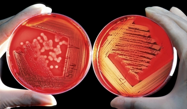 البكتيريا المُقاومة للمُضادّات تُهدّد أوروبا