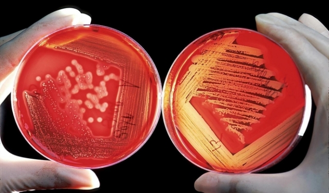 دراسة: بكتيريا خطيرة في مياه الصرف الصحي المعالجة 