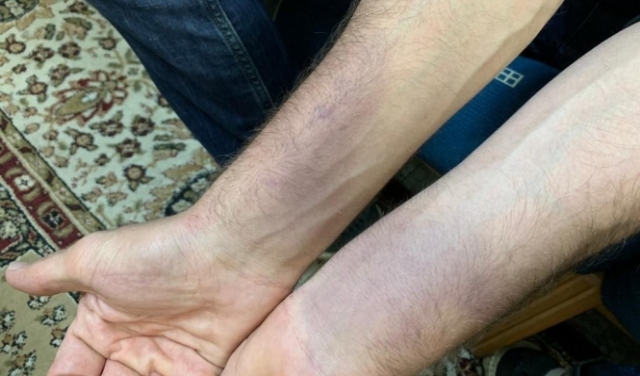 طبيب يتعرض لاعتداء من الشرطة في حيفا