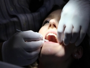 دراسة: تبييض الأسنان ضرر لصحة الفم 