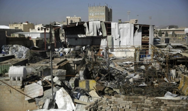 اليمن: خسائر 88 مليار دولار وعودة 20 عاما للوراء