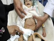 "يونيسيف": حرب اليمن أدت إلى مقتل 7300 طفل على الأقل 