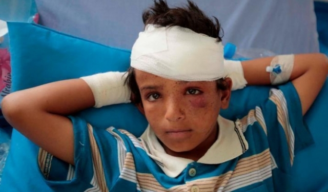 تقرير: أكثر من 90 ألف شخص لقوا حتفهم في الحرب على اليمن 