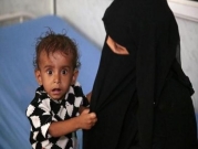 اليمن: 8 من كل 10 أشخاص يعتاشون على المساعدات
