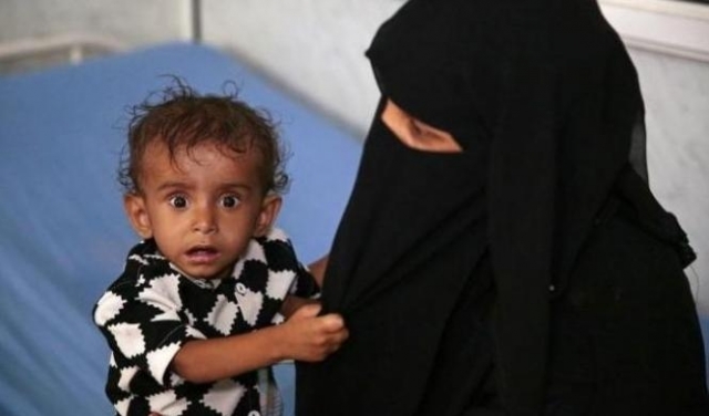 اليمن: 8 من كل 10 أشخاص يعتاشون على المساعدات