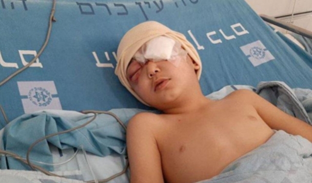 إصابة خطيرة لطفل برأسه برصاص الاحتلال في العيسوية