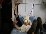 استئصال عين الطفل مالك عيسى الذي أُصيب برصاص الاحتلال