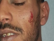 تل السبع: تأجيل فرح بلال الأعسم إثر اعتداء الشرطة عليه