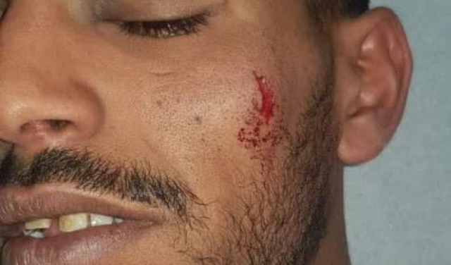 تل السبع: تأجيل فرح بلال الأعسم إثر اعتداء الشرطة عليه