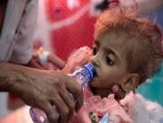 الأمم المتحدة تحذّر من مجاعة في أربع دول منها اليمن