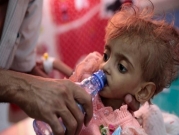 "الصحة العالمية": مرض الدفيتريا لا يزال متوطنا في اليمن
