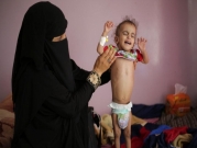 الأمم المتحدة تحذَر: اليمن يقترب من أسوأ مجاعة عرفها العالم منذ عقود