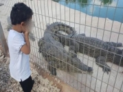 تحسن حالة الطفل من يافا بعد تعرضه لعضة تمساح