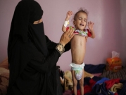 برنامج الأغذية العالمي يُحذّر: مجاعة وشيكة في "جحيم" اليمن