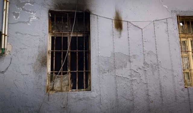 تدهور حالة الطفل المصاب بإحراق المنزل في حيّ العجمي بيافا