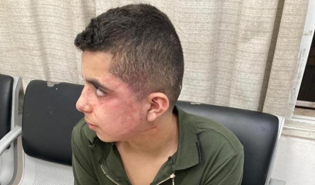 الطيبة: الشرطة تعتدي بالضرب المبرح على فتى