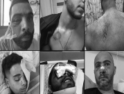 أسلحةُ القمع الإسرائيلية |  شهادات المصابين: "أرادوا قتلي وليس إبعادي"