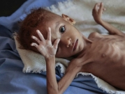 تدهور العملة يحرم ملايين اليمنيين من الغذاء