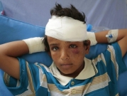  10 آلاف طفل قُتِلوا أو شوهوا خلال الحرب في اليمن