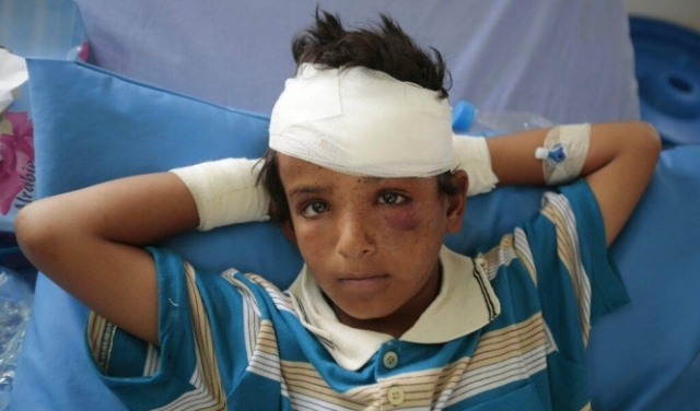  10 آلاف طفل قُتِلوا أو شوهوا خلال الحرب في اليمن