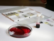 فئات الدم النادرة... شواهد غير معروفة على تنوّع البشر