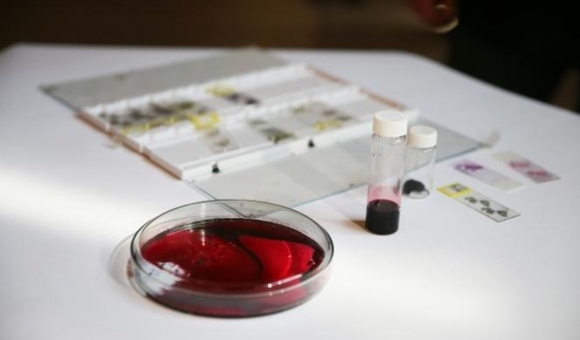 فئات الدم النادرة... شواهد غير معروفة على تنوّع البشر