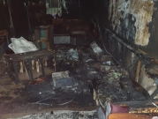 9 إصابات جراء حريق منزل في بيت حنينا