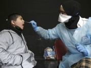 الصحة الإسرائيلية: 76 ألف إصابة بكورونا أمس وحصيلة الوفيات 8502