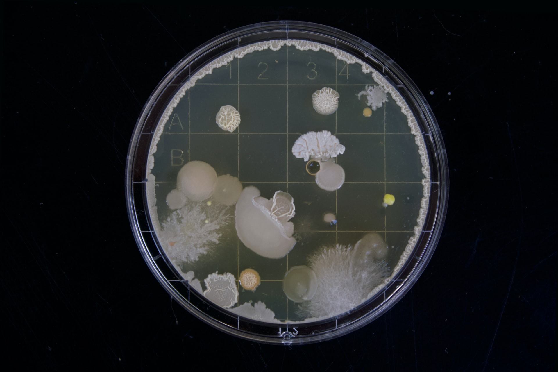 لمس الأسطح والأجسام الملوثة بالرذاذ الذي يحمل البكتيريا