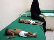 الأطفال في اليمن ما زالوا يموتون جوعا رغم الهدنة