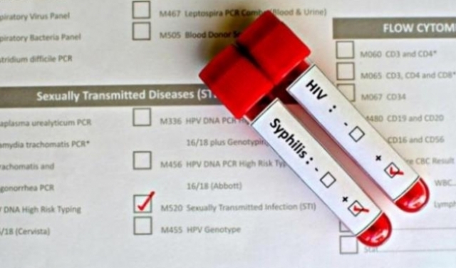 الشفاء التام من الإيدز؟ حالات معزولة ولا حلول سحريّة