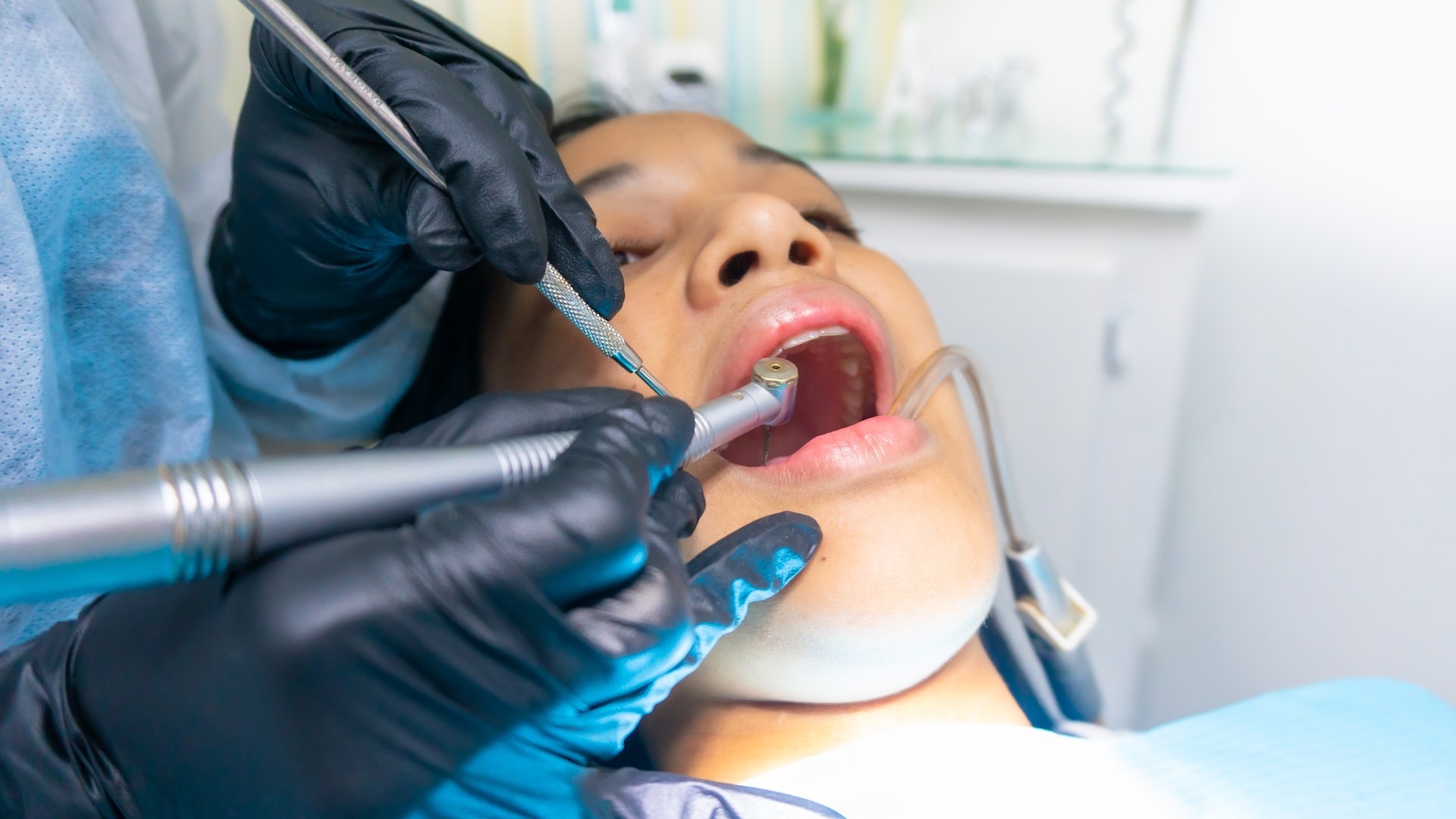 عوامل تساعد في منع تسوس الأسنان