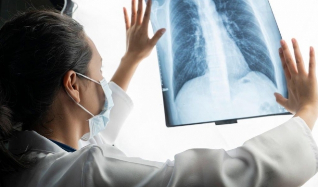 بحث يكشف العلاقة بين تلوث الهواء وبعض سرطانات الرئة