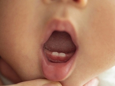 دليلك الشامل عن الأسنان التي يولد بها الأطفال